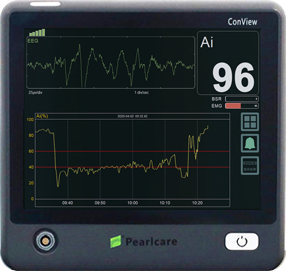 ConView YY-106 anesthesia depth monitor